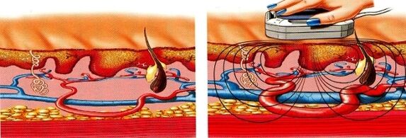 cuando tus piernas se adormecen